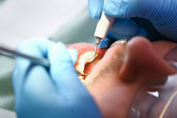 Best Emergency Dental Surgery in Assumption, IL