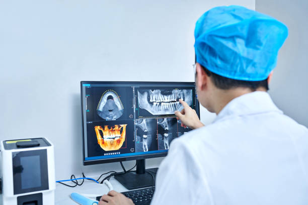 Best Emergency Tooth Extraction in Assumption, IL
